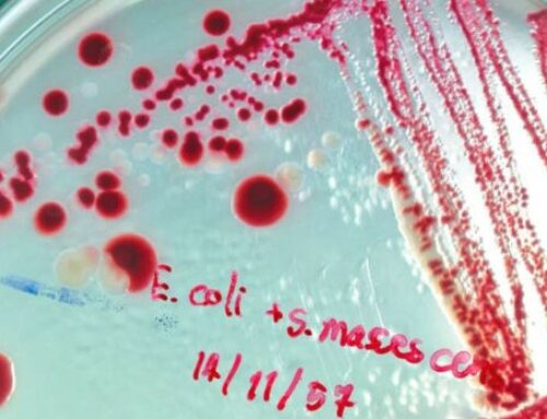 Un puissant antibiotique découvert grâce à l’intelligence artificielle