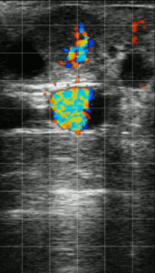 Corpus-luteum-CFM-on-ESG